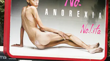 Isabelle Caro ritratta da Oliviero Toscani per una campagna contro l'anoressia, in un'immagine del 24 settembre 2007 ripresa a Roma. E' morta a soli 28 anni, la modella e attrice francese Isabelle Caro, gravemente anoressica, salita agli onori della cronaca per aver posato nuda in uno spot anti-anoressia di Oliviero Toscani per la marca italiana Nolita. Il decesso è avvenuto a Tokyo il 17 novembre scorso, ma la notizia è stata diffusa solo oggi, prima dal sito del quotidiano svizzero '20 minutes' e poi da quello del settimanale francese Paris Match. L'immagine della Caro, che pesava solo 31 chili per 1 metro e 65, nelle foto di Toscani aveva fatto molto discutere in quanto ritenuta troppo esplicita e scioccante, tanto che il giurì per la pubblicità aveva vietato la campagna. GIUSEPPE GIGLIA/ ANSA