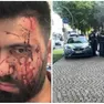 Il negoziante aggredito e un controllo della polizia in via Roma
