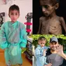Il piccolo Osama, curato all'ospedale di Verona