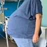 Rimosso ad Aviano un sarcoma addominale di 15 chili: la foto della paziente prima dell'intervento
