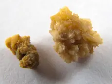 I ladri hanno rubato due calcoli renali, scambiandoli per pietre preziose (foto d'archivio)