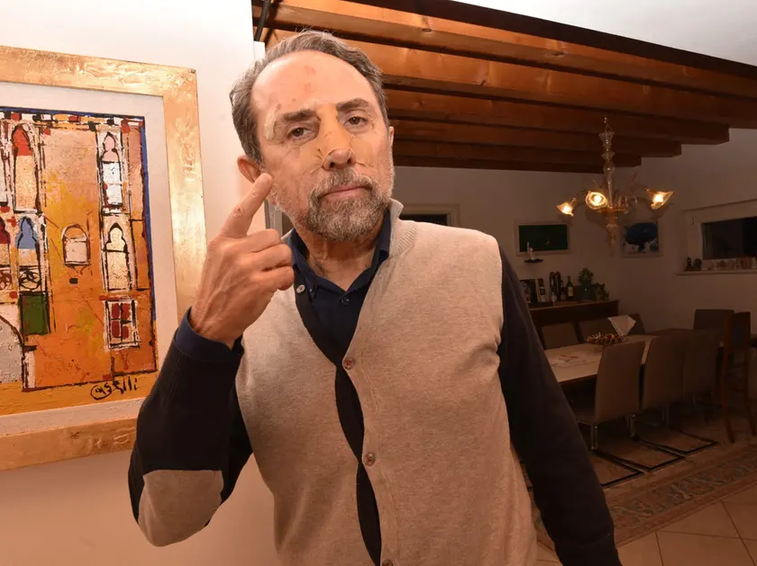 Alessandro Bubola tornato venerdì sera a casa dopo le cure in day hospital