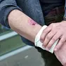 Le ferite riportate da Giovanni Galletti in seguito all'aggressione