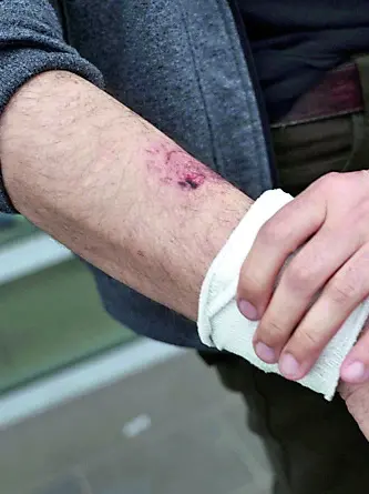 Le ferite riportate da Giovanni Galletti in seguito all'aggressione