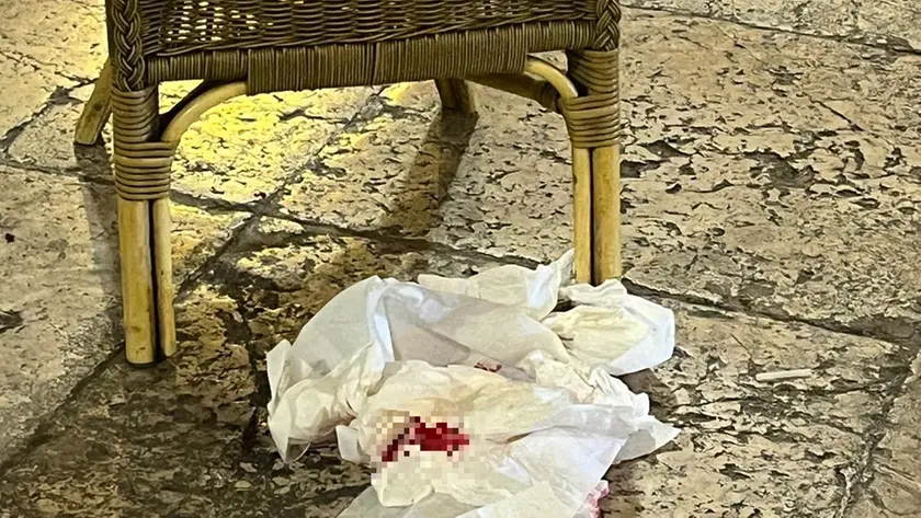 Il sangue dopo l'accoltellamento