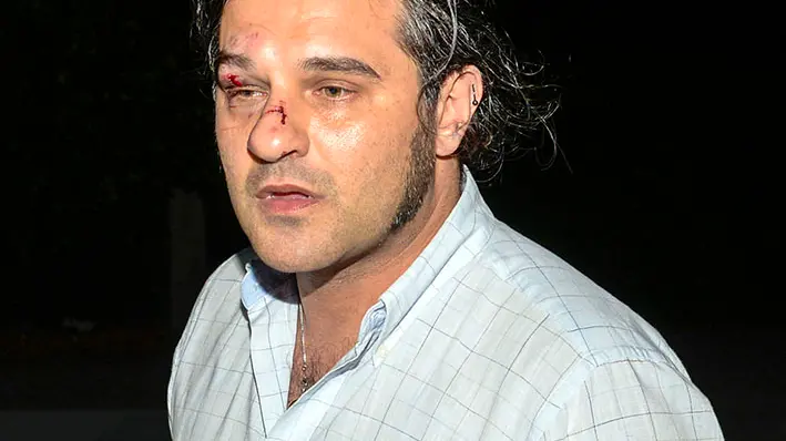 Mauro Marin mostra i segni dell'aggressione