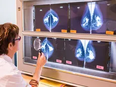 Le immagini di un esame mammografico (Foto d'archivio)